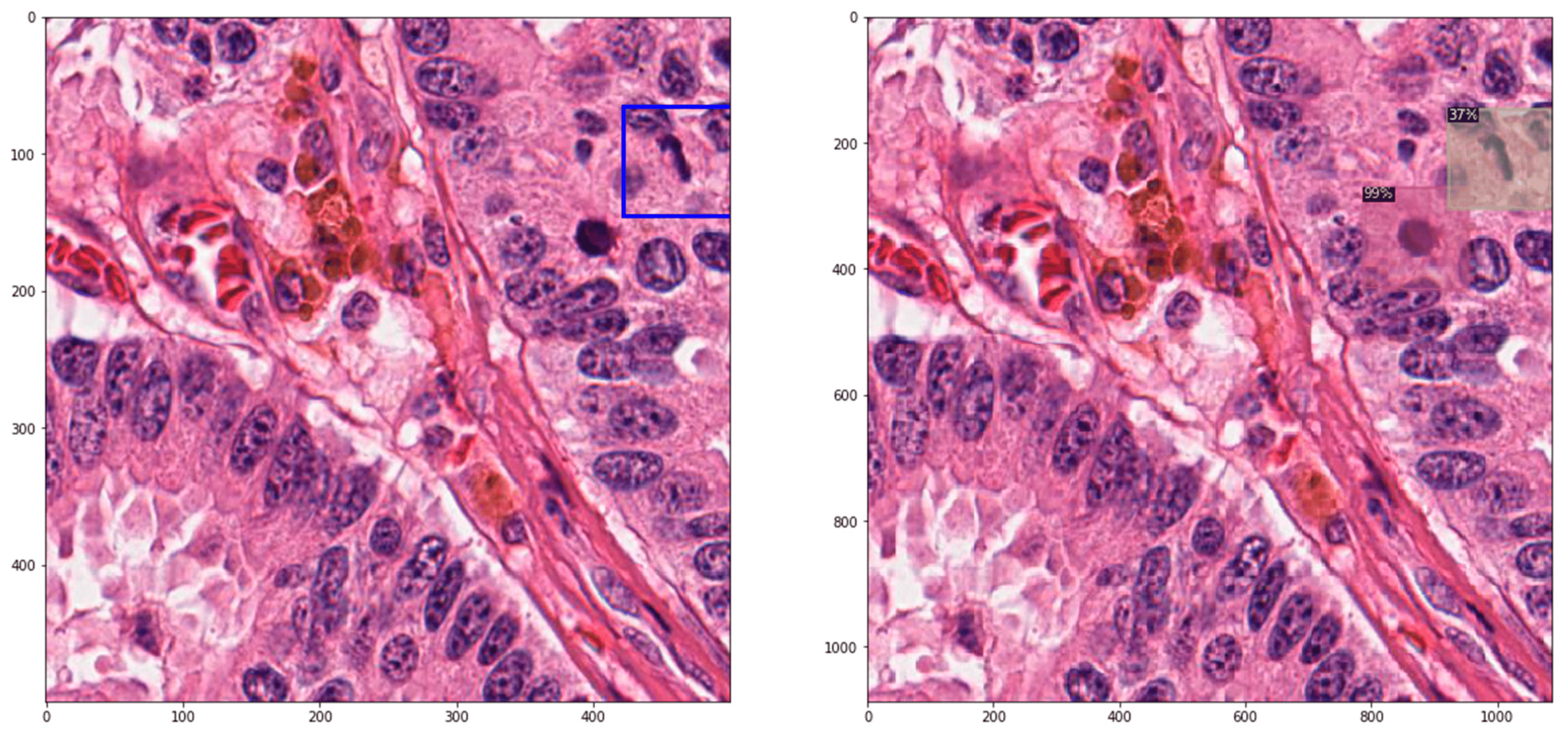 The Value of Accuracy: Driving Pathological Advancement Using Whole Slide Imaging